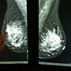 Researchers Identify Possible New Risk for Breast Cancer