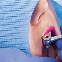 Essential Tools: Exploring Common Dental Supplies For Implant Procedures In Gainesville, VA