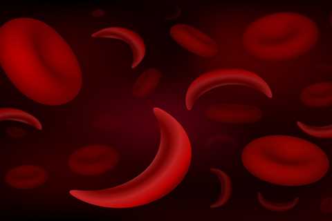January 23 2024 - Sickle cell gene therapies seen as cost effective below $2M threshold