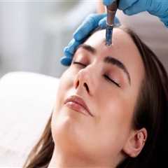 Microneedling 101: Why Consulting A Health Professional In Phoenix Is Essential For Skin Health