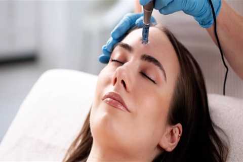 Microneedling 101: Why Consulting A Health Professional In Phoenix Is Essential For Skin Health