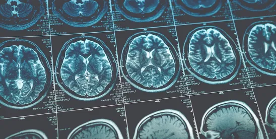 New Research Shows Mild Traumatic Brain Injury Symptoms Can Persist for Years