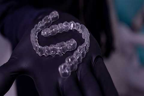 Brighten Your Smile with Custom Clear Braces in Mill Creek