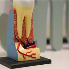 Effective Root Canal Treatment in Zurich: Pain Relief & Oral Health