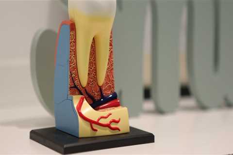 Effective Root Canal Treatment in Zurich: Pain Relief & Oral Health